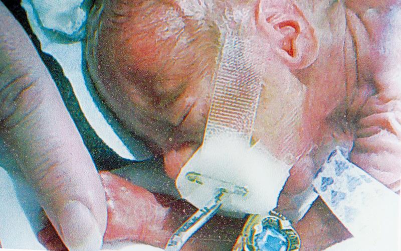 William Cable has came a long way from weighing 1 pound, 2 ounces at birth – so small that his brother’s class ring could fit on his arm.