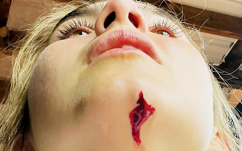 Little did spectators know that Memory Frapp suffered a deep laceration on her chin while diving back to second base during a second-inning rundown against Swain. She later received three stitches for her troubles.